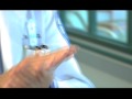 \"What is Avascular Necrosis?\" featuring Dr. Sculco (ArthritisMD)