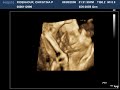 baby ridenhour