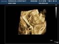 baby ridenhour