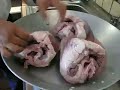 CORAZÓN PARA MÉDICOS Y TACTO AL MIOCARDIO