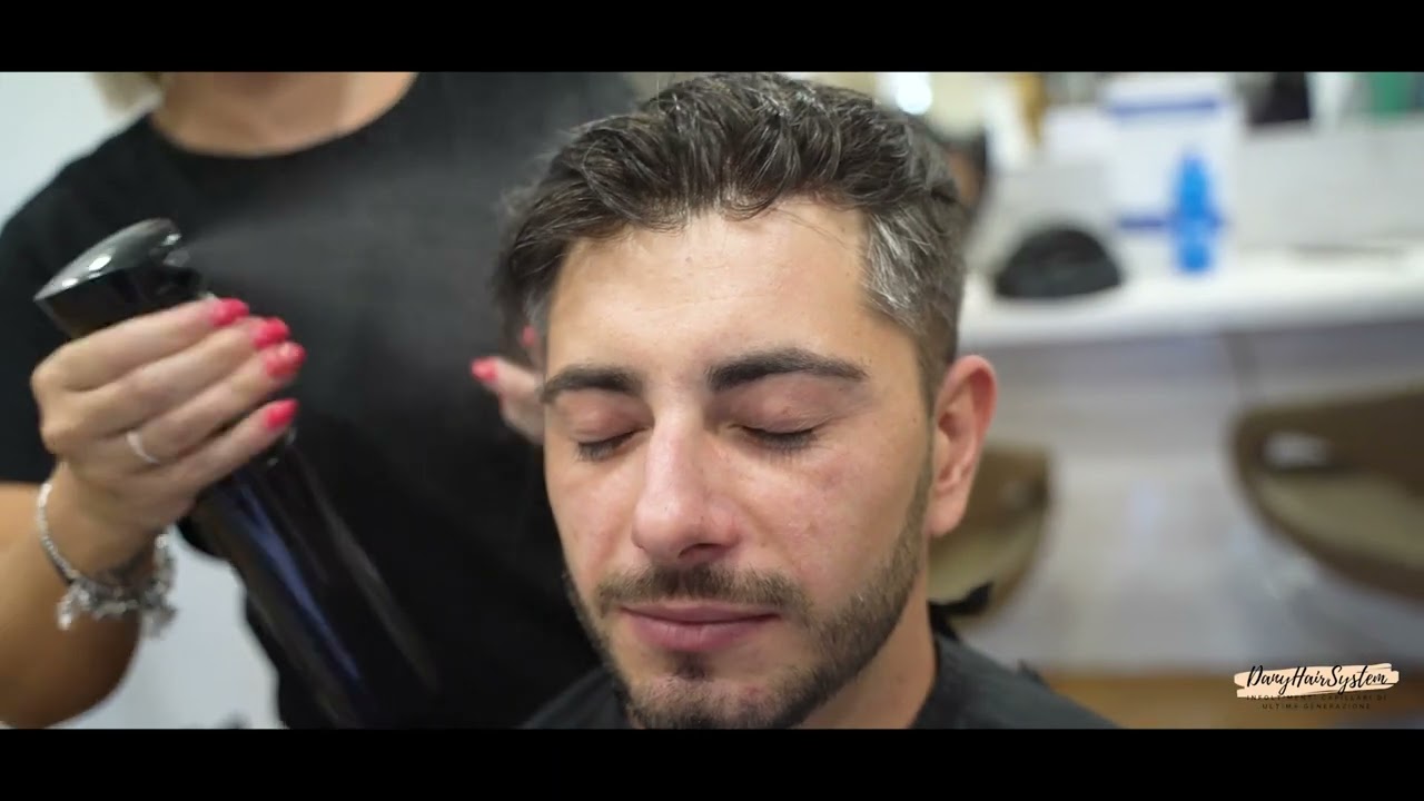 -Infoltimento capelli- DANYHAIRSYSTEM - la PROTESI o patch per capelli PRIMA E DOPO