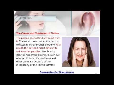 Acupuncture For Tinnitus