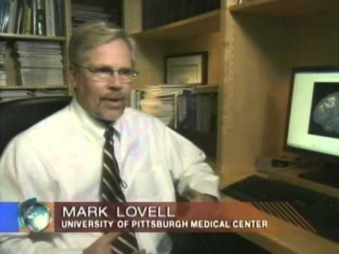 how to treat concussion