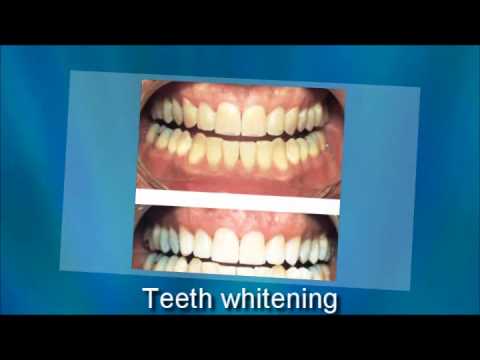 how to relieve tooth zingers