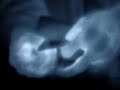 FLIR thermal infrared camera: Rubber Band hot/cold