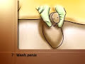 PostCare™ Urinary Center: Male External Urinary Collecting