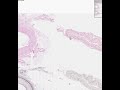 Shotgun Histology Medium Artery and Vein