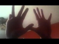 Dare You To Move :[ A Mental Ilness Story] Epi 8