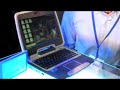Intel Atom Netbook