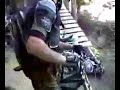 skateboard broken leg