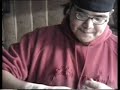 James dislocates his finger!!!