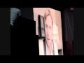 See video