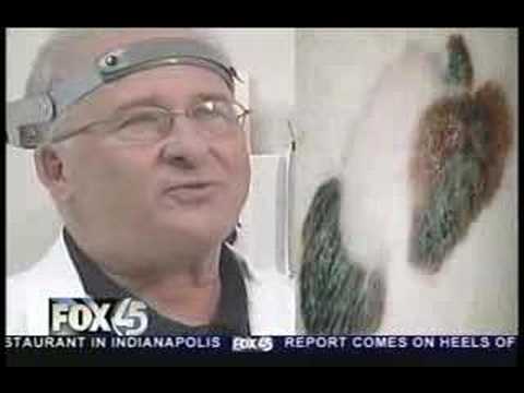 Monte Meltzer, Dermatologist, Talks ...