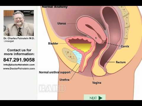 how to treat urinary incontinence