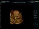 My son- 30weeks- 4D