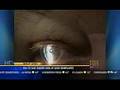 denver laser eye correction