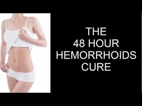 how to treat external hemorrhoids