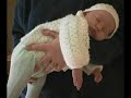 how to avoid flat head (plagiocephaly) in newborns