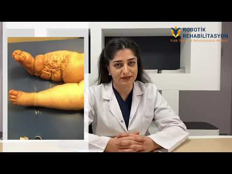 Robotik Rehabilitasyon Merkezi