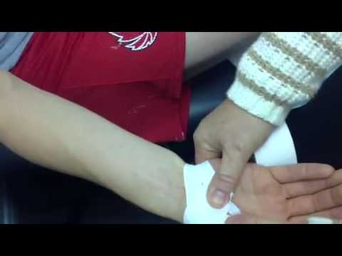 how to measure mp joint