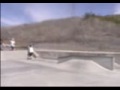 Razor vs. Know-Ped Part 2