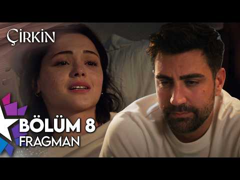 Çirkin 8. Bölüm Fragmanı                                                                                                                                                                                                                                  