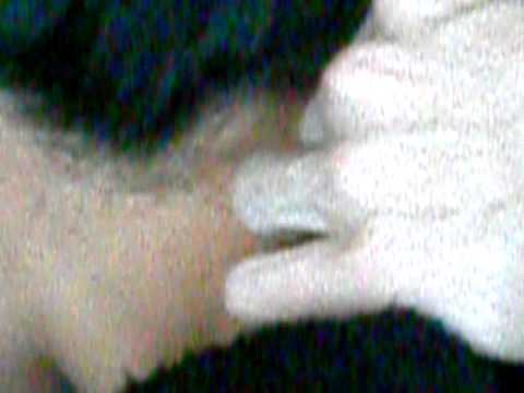 Nape Piercing done by * Chip Indoe*