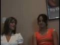 18 yo Dancer Spinecor Brace, Scoliosis Systems Testimonial 6