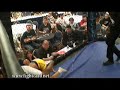 Tim Barnett VS Lawrance Alvis Ray Tim Barnett VS Lawrance Alvis Ray