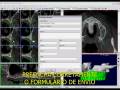 videos de Bioparts - Enviando Pedido com o DentalSlice