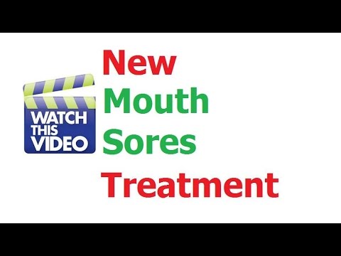 how to cure aphthous ulcer