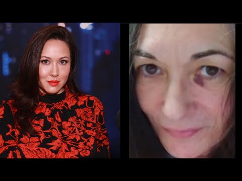 Images Surface Of Ghislaine Maxwell Behind Bars With Black Eye – Attack