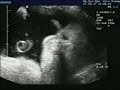 obstetricia