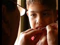 Endodoncia artesanal la cirugia, diente de leche