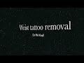 Wrist tattoo removal