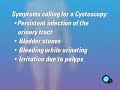 PreOp® Patient Education: Cystoscopy Female Surgery