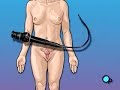 PreOp® Patient Education: Cystoscopy Female Surgery