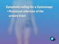 PreOp® Patient Education: Cystoscopy Female Surgery