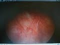 Operation Dr. H Badran Operation Dr. H Badran
