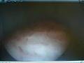 Operation Dr. H Badran