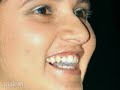 sania