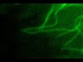Microtubule dynamics in live cells