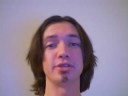 Re: Re: Re: Corrective Jaw Surgery Underbite Post Surgery
