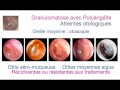 Click to View : Atteintes ORL - Vascularites - Dr.Michel - Septembre 2016
