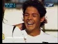 MATIGOL el mejor