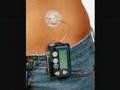 Type 1 Diabetes