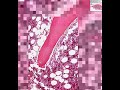Shotgun Histology Spongy Bone