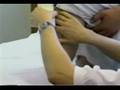 Meike Brouwer Rehab - stumps bandaging technique