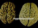Myth 2 - People \