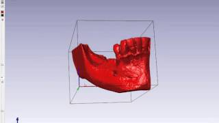 Создание 3Д-модели челюсти для блока RBB